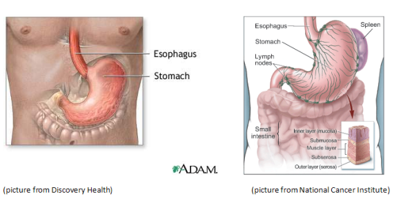 Gastric