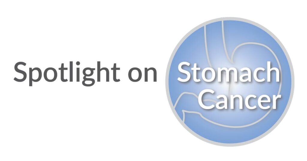 Spotlight on Stomach Cancer written over image of a stomach